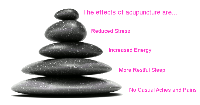Acupuncture Therapy