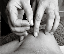 What is Oriental Medicine?